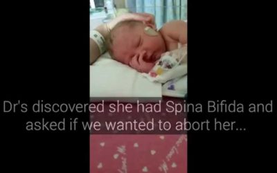 Choosing Life for Amnesty Part 1 – Born With Spina Bifida